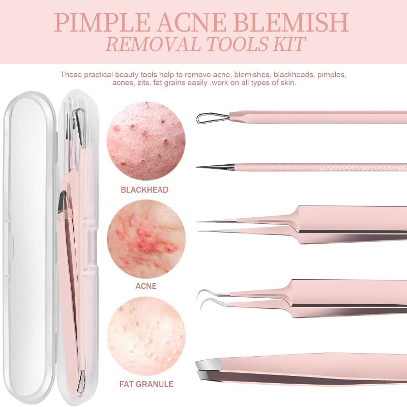 SerenoVita Professional Blackhead Tool Set